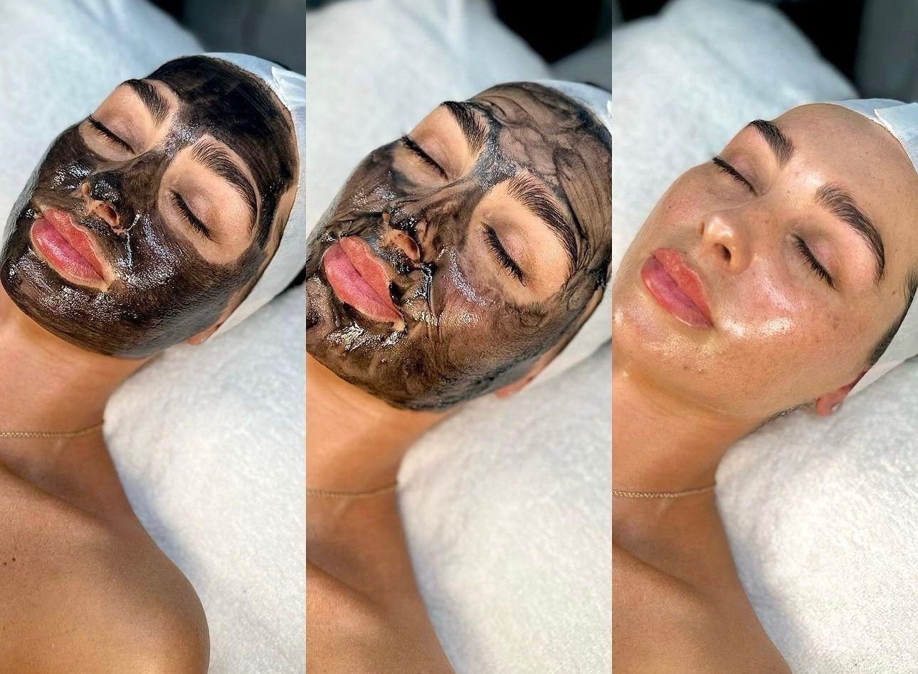 Tres etapas de un cuidado facial: aplicación de mascarilla y piel limpia al finalizar