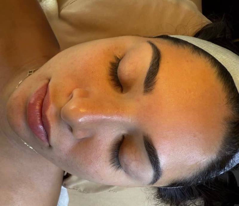 Piel antes del Facial Deep Clean