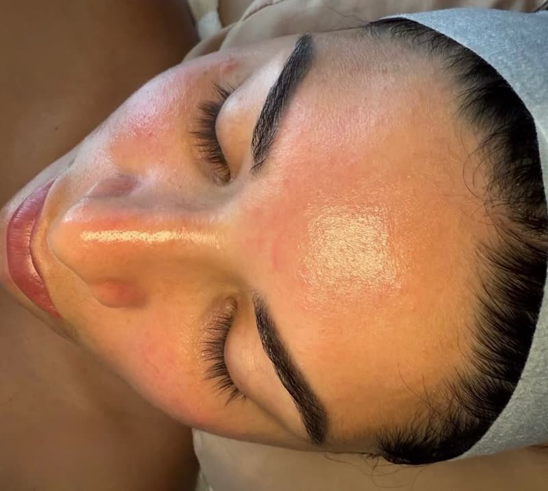 Piel después del Facial Deep Clean con cóctel de vitaminas