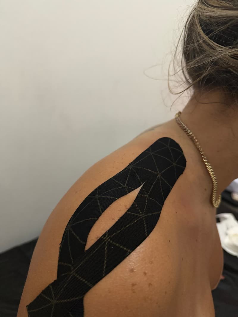 Kinesio tape aplicado en hombro para drenaje linfático kinesiológico